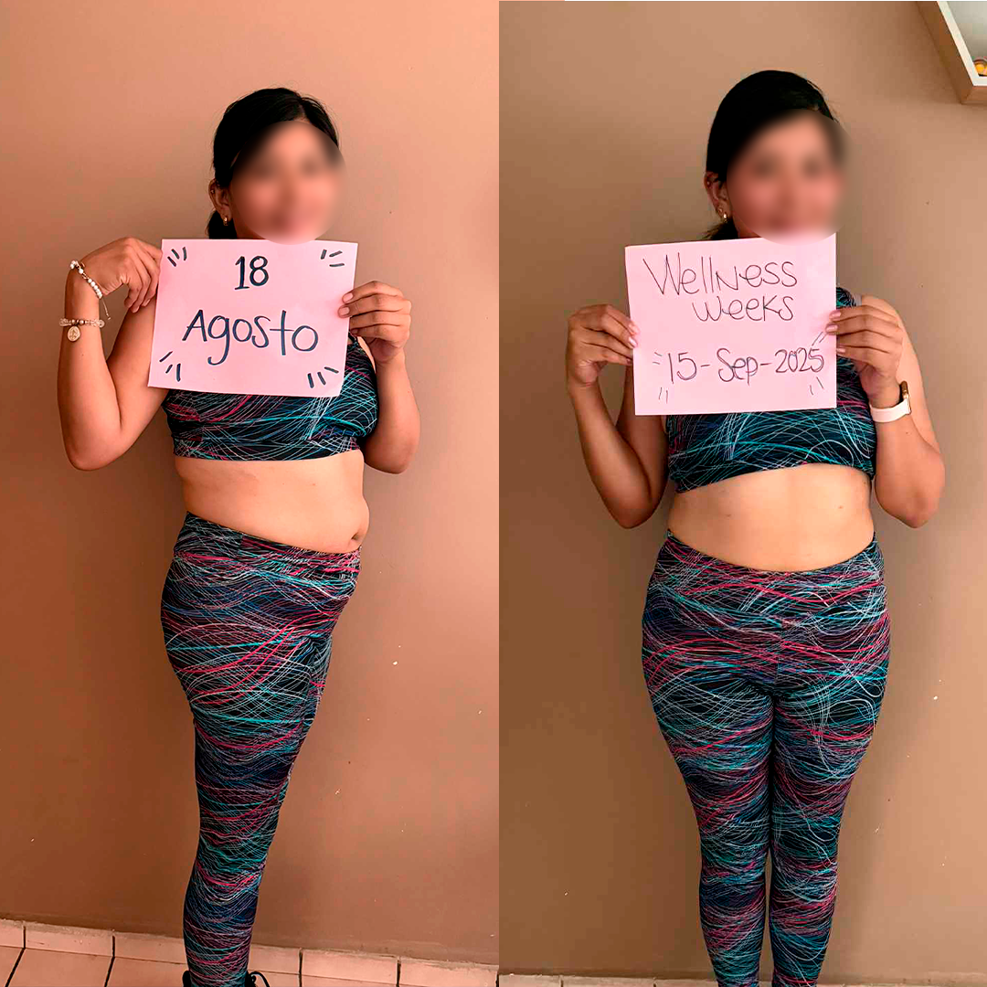 BEFORE-AFTERWW5